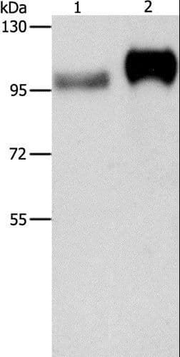 ITGB3 / Integrin Beta 3 / CD61 Antibody