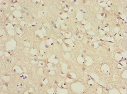 TCEAL7 Antibody