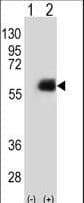 NMT2 Antibody (aa16-46)