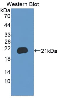 BRD8 Antibody (aa797-951, APC)