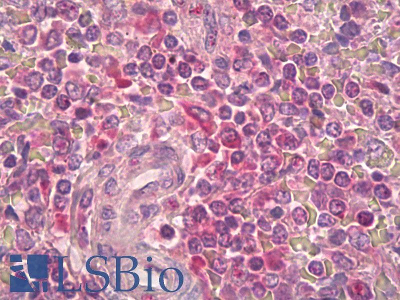 IHC-plus™ IL2RB / CD122 Antibody (aa331-380)