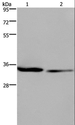 EMD / Emerin Antibody
