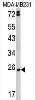 LTA / TNF Beta Antibody (aa46-72)