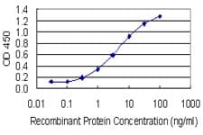 DDH / AKR1C1 Antibody (clone 1B3)
