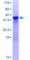 Human SAMD4A Protein (Recombinant GST)