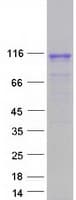 Human DGCR8 Protein (Recombinant Myc-DDK (Flag))