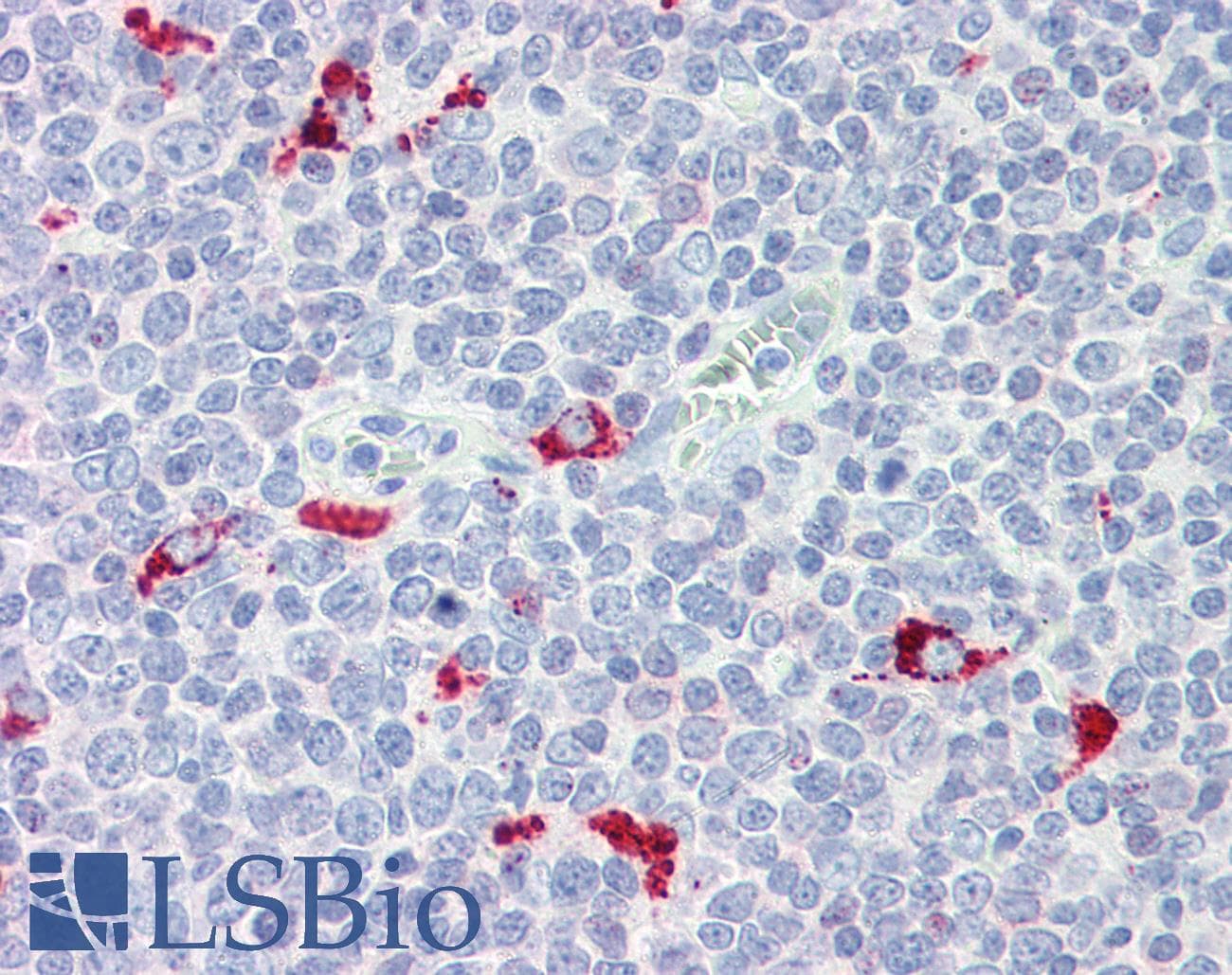 IHC-plus™ IRF7 Antibody (aa1-150, clone 3D9)