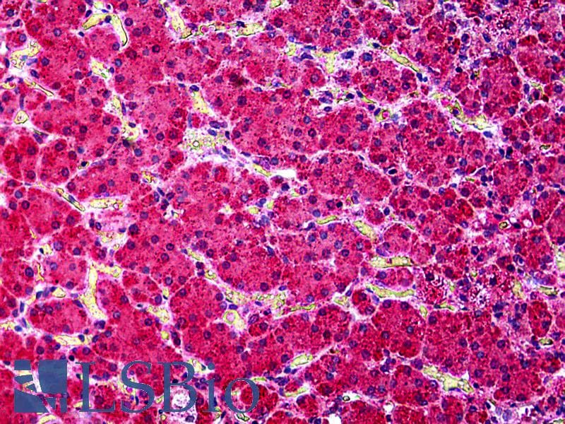 IHC-plus™ Polyclonal Goat anti-Human KCNN4 / KCa3.1 Antibody (aa227-239, IHC, IF, WB)