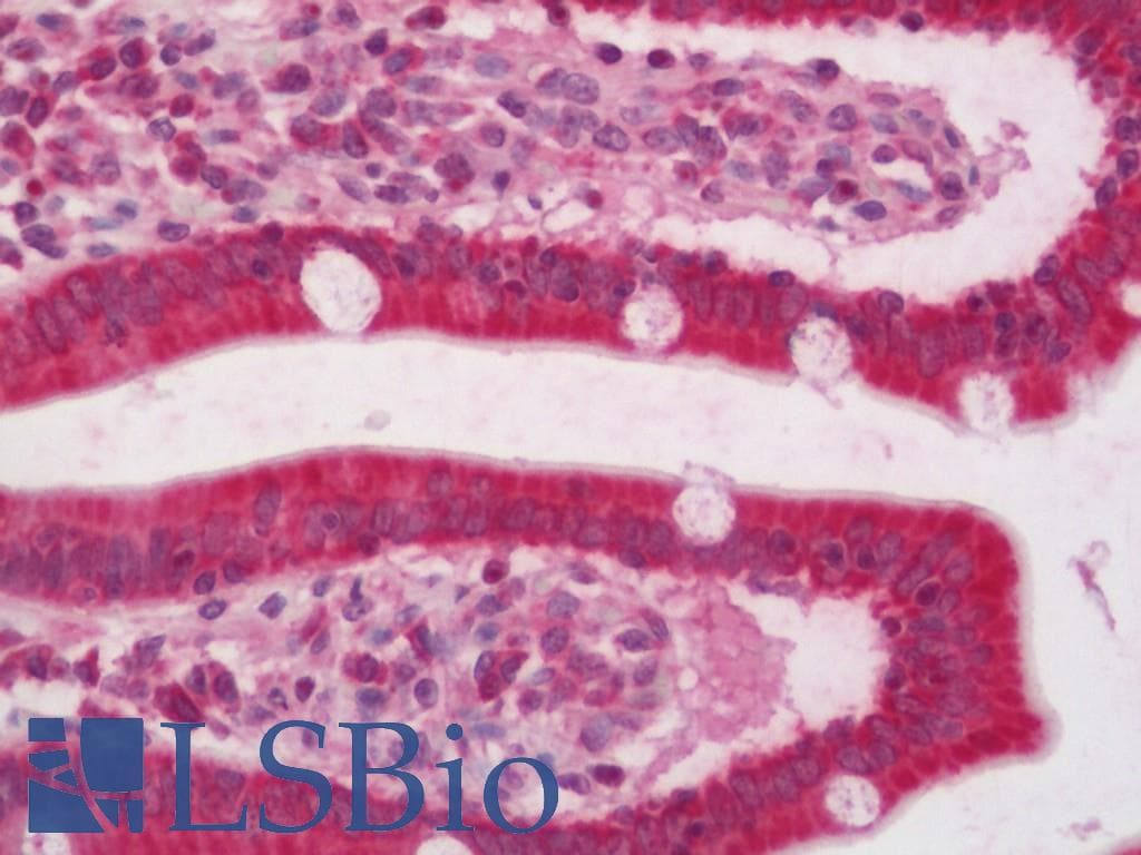NDUFB7 / B18 Antibody (FITC)