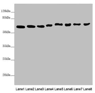 MCCC2 / MCCB Antibody