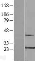 MYL4 Protein (Over-Expression Lysate Myc-DDK (Flag))