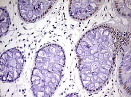 Monoclonal Mouse anti-Human CDCA7L Antibody (clone OTI1A12, aa1-337, IHC, WB)