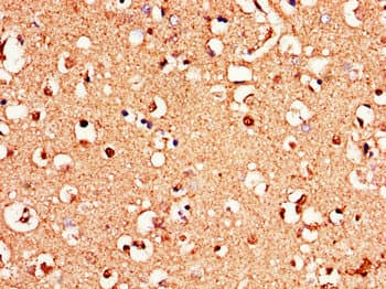 GRM1 / MGLUR1 Antibody