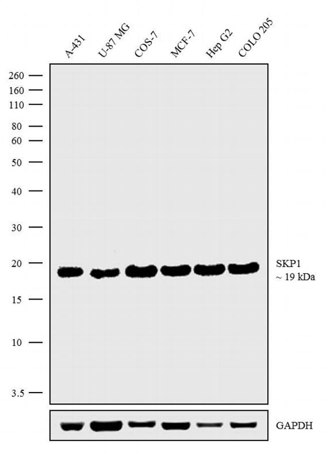 SKP1 Antibody (clone 4E+11)