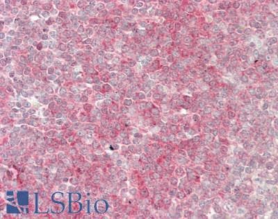 IHC-plus™ CD119 / IFNGR1 Antibody (C-Terminus)
