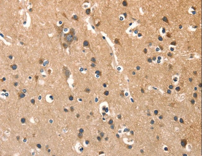 Polyclonal Rabbit anti-Human AGO1 / EIF2C Antibody (IHC)