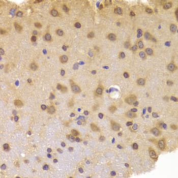 ROCK2 Antibody