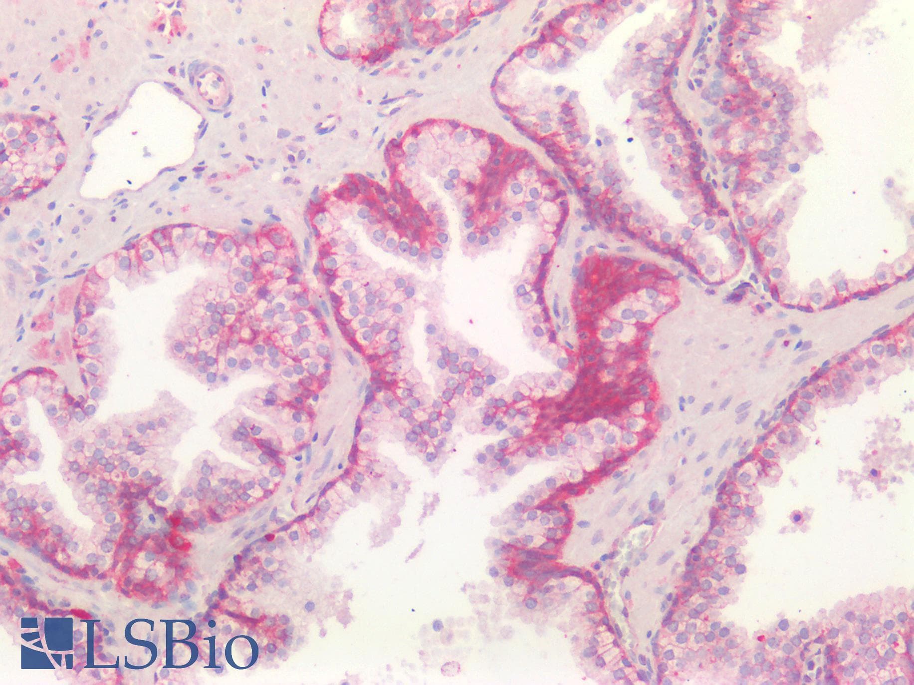PathPlus™ Polyclonal Rabbit anti-Human CTNND1 / p120 Catenin Antibody (IHC)