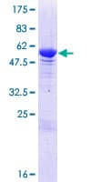 Human ANKRD45 Protein (Recombinant GST)