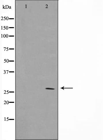 Polyclonal Rabbit anti-Human BCL2 / Bcl-2 Antibody (IHC, IF, WB)