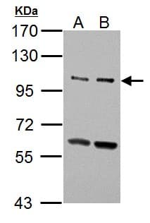 ULK2 Antibody (aa693-968)