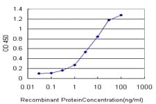Monoclonal Mouse anti-Human STK38 Antibody (clone 2F6, IHC, IF, WB)