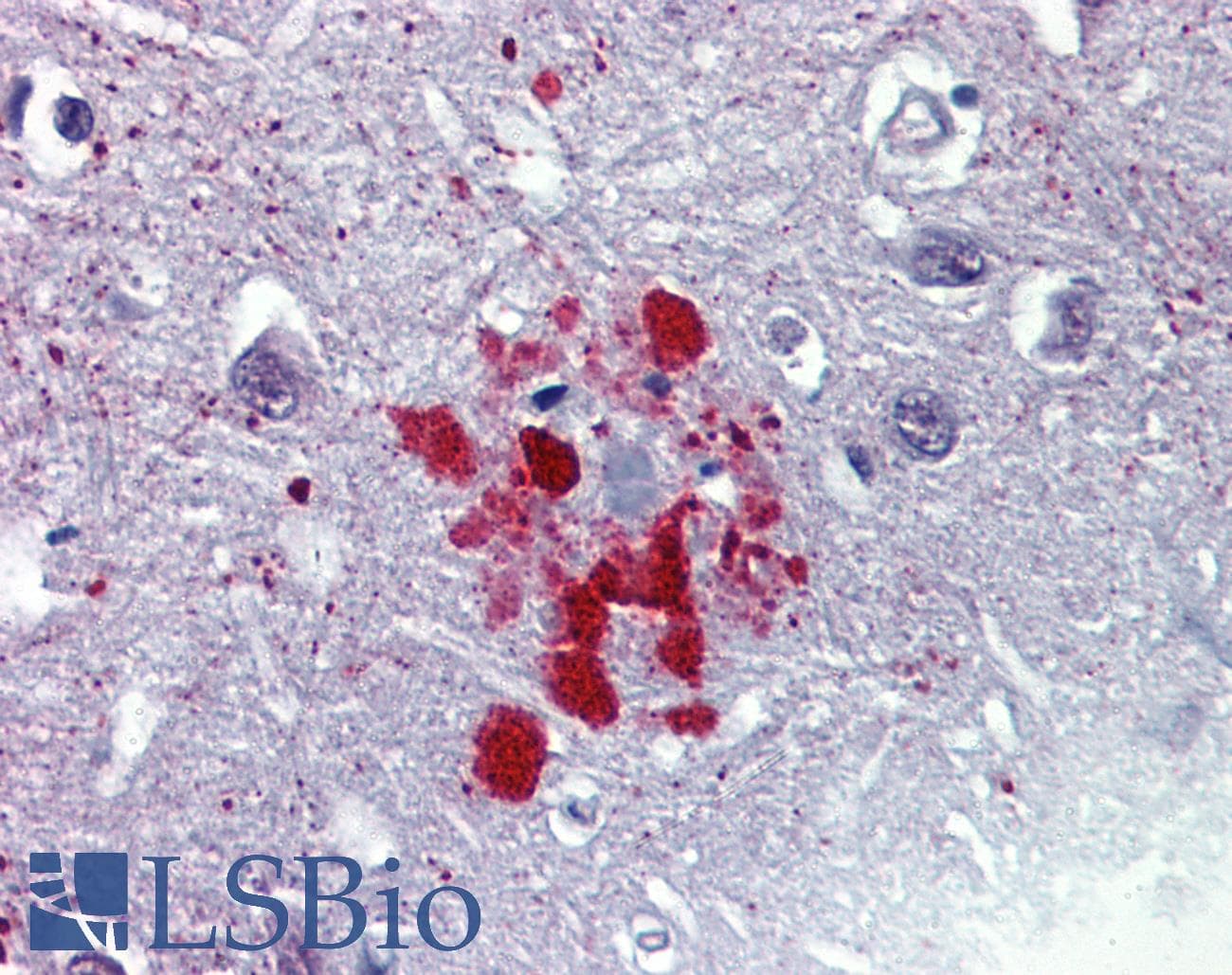 IHC-plus™ Monoclonal Mouse anti-Bovine Ubiquitin Antibody (IHC, IF, WB)