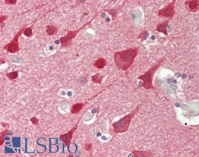 PathPlus™ Polyclonal Rabbit anti-Human STMN1 / Stathmin / LAG Antibody (aa5-54, IHC, IF, WB)