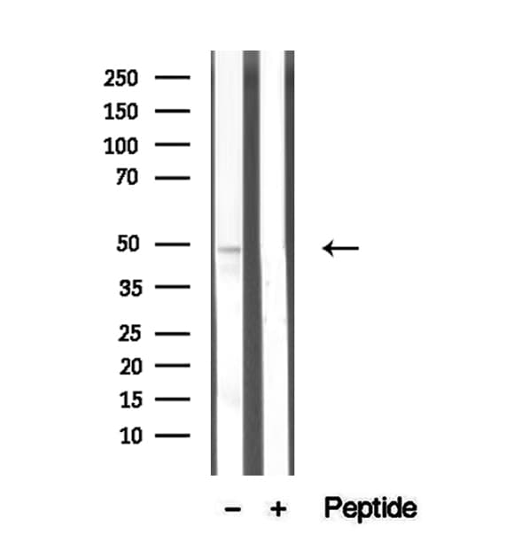 TARBP2 / TRBP2 Antibody