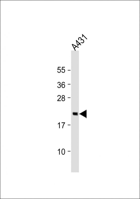 RAP2 Antibody (aa124-159)