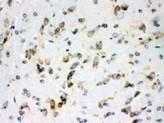 PRDX4 / Peroxiredoxin 4 Antibody