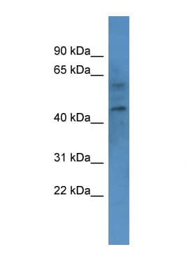 CNR1 / CB1 Antibody (aa73-122)
