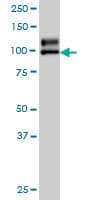 NDST1 Antibody (clone 1G10)