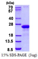 Human VAMP7 / SYBL1 / T1 VAMP Protein (Recombinant His)