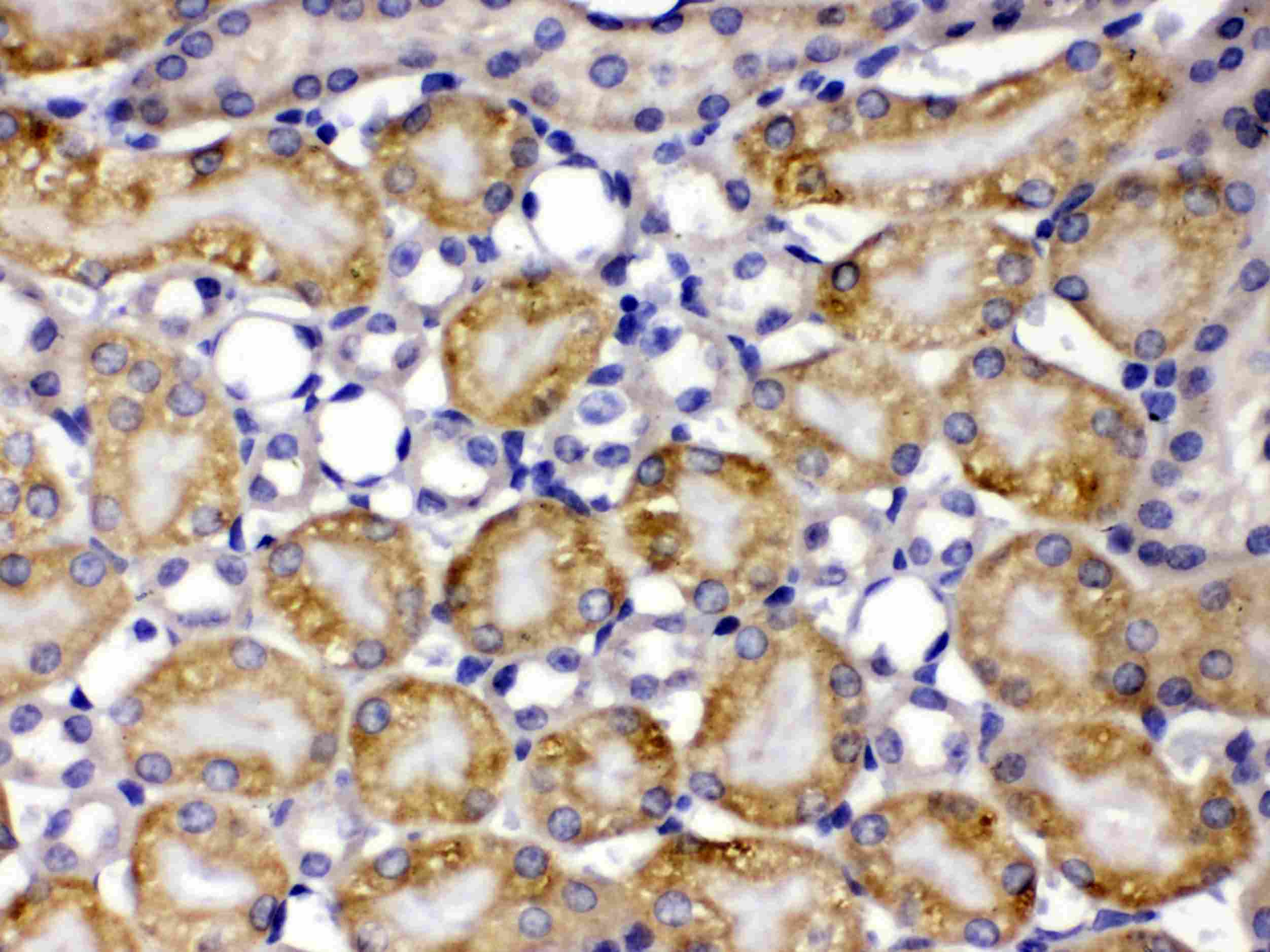 Polyclonal Rabbit anti-Human CCT8 Antibody (IHC, WB)