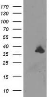 UNG / Uracil DNA Glycosylase Antibody (clone OTI2F3)