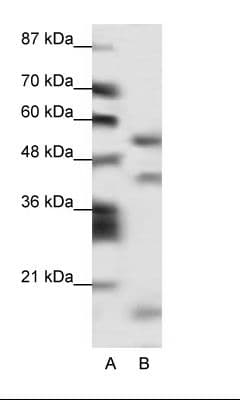 LHX1 Antibody (aa120-169)