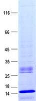 Human C7orf66 Protein (Recombinant His, N-Terminal)