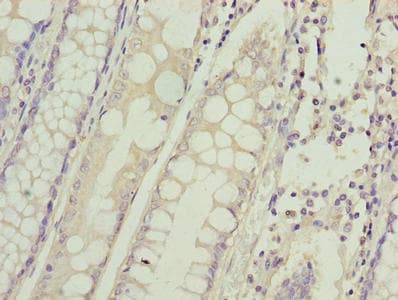 HIGD1B Antibody