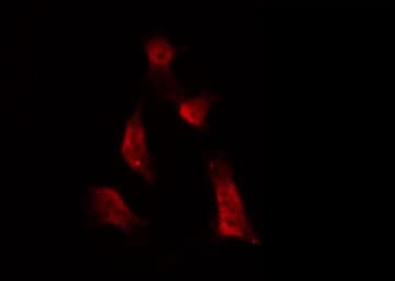 ATRIP Antibody (phospho-Ser68)