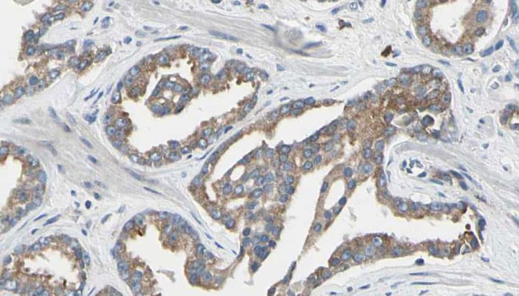 ASNS Antibody
