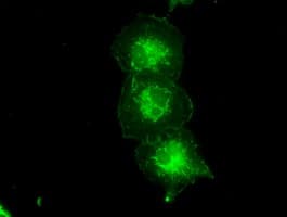 Monoclonal Mouse anti-Human TYRO3 Antibody (clone OTI5B7, IF)
