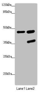 Polyclonal Rabbit anti-Human SERPINB6 / PI-6 Antibody (IHC, WB)