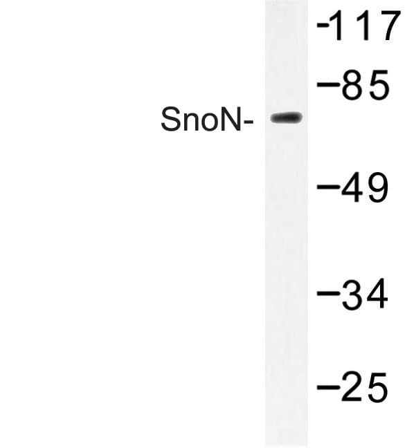 SKIL / SNO / SnoN Antibody (Asp652)