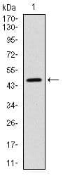 Monoclonal Mouse anti-Human YAP / YAP1 Antibody (clone 1A12, IHC, WB)