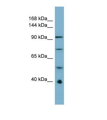 Polyclonal Rabbit anti-Human RBBP6 Antibody (aa13-62, WB)