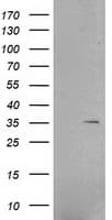 RNF144B Antibody (clone OTI6B11)