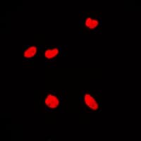 Polyclonal Rabbit anti-Human MYST2 / HBO1 Antibody (Internal, IF, WB)