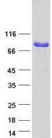 Human SCIN Protein (Recombinant Myc-DDK (Flag))
