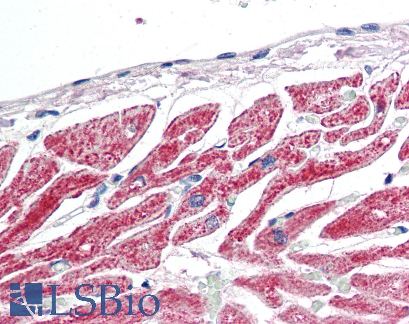 IHC-plus™ BRAF / B-Raf Antibody (clone 1H12F1)